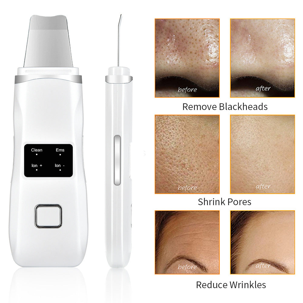 Ultrasonic Peeling Machine HailiCare Positive And Negative Ions Red And Blue Light To Remove Blackheads And Acne Beauty Instrument